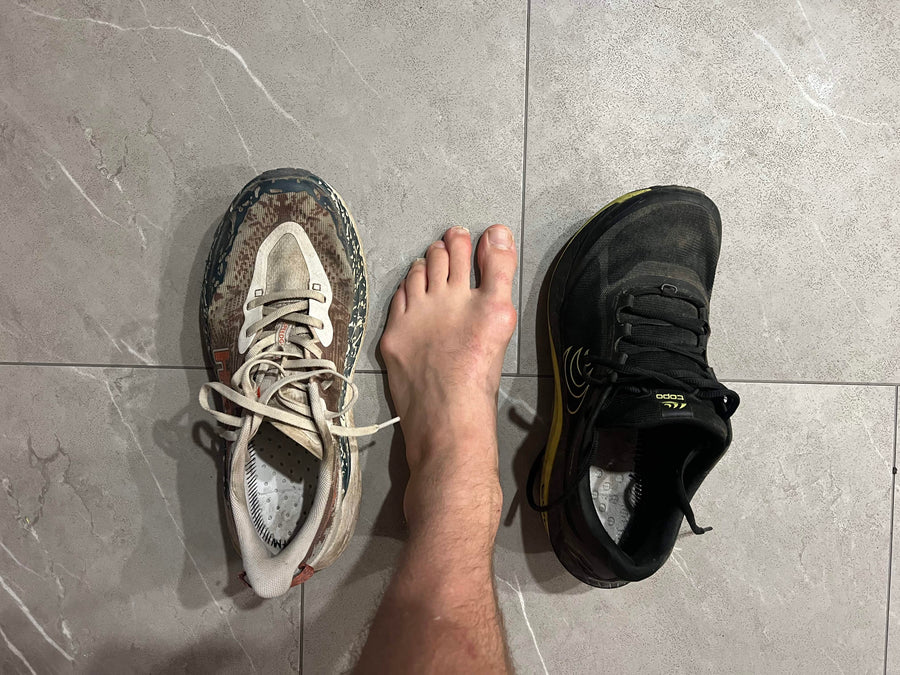 Running with bunions: choosing shoes that fit the shape of your foot